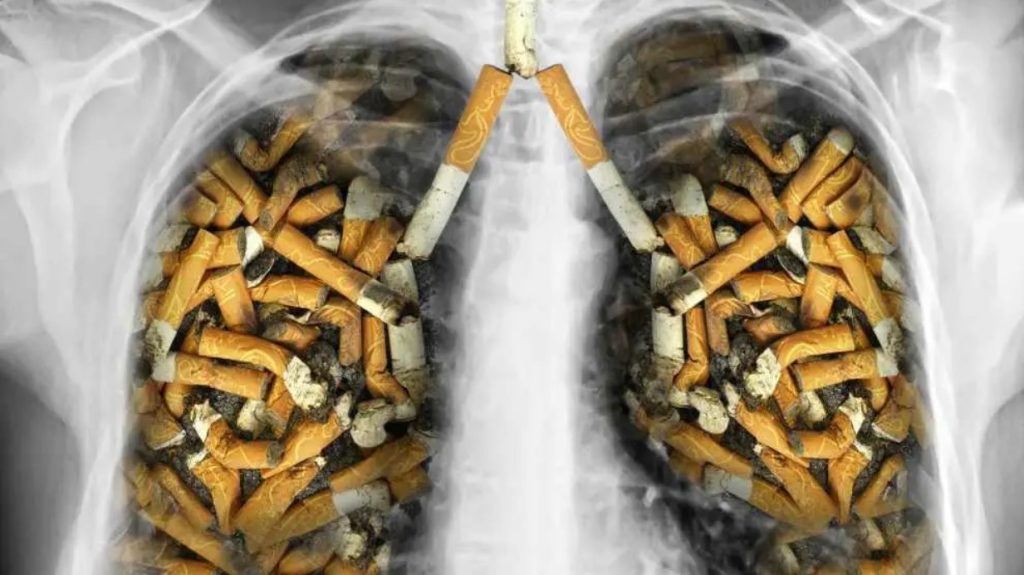 Tüdőrák cigarettafüst miatt: így lehet megelőzni